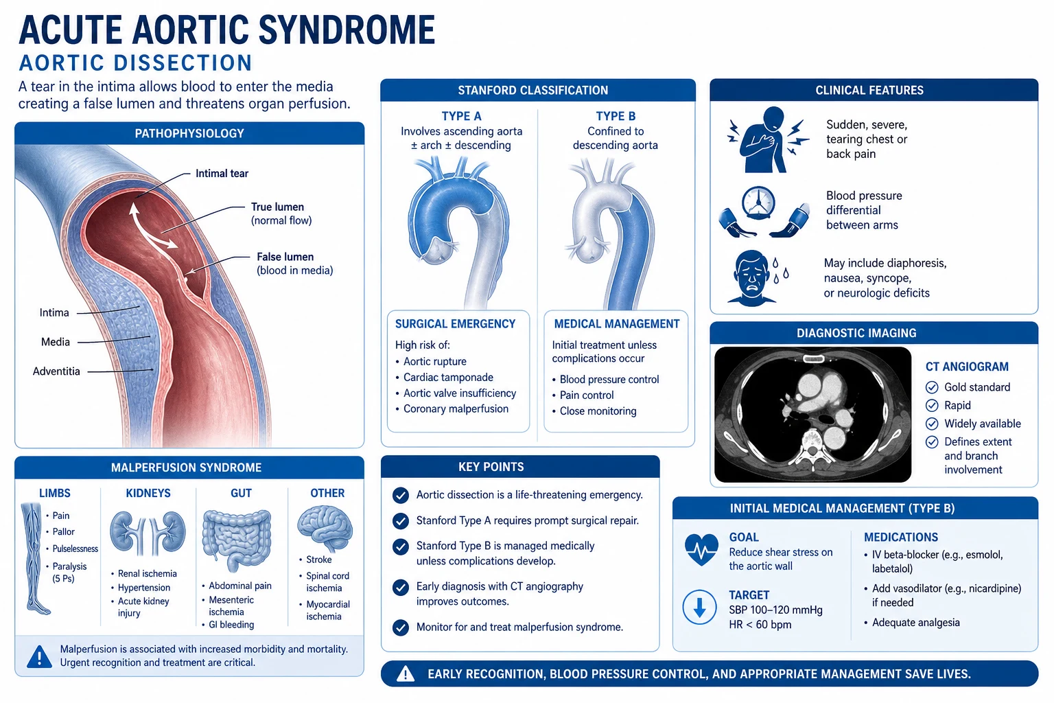 Acute Aortic Syndrome pathophysiology educational diagram
