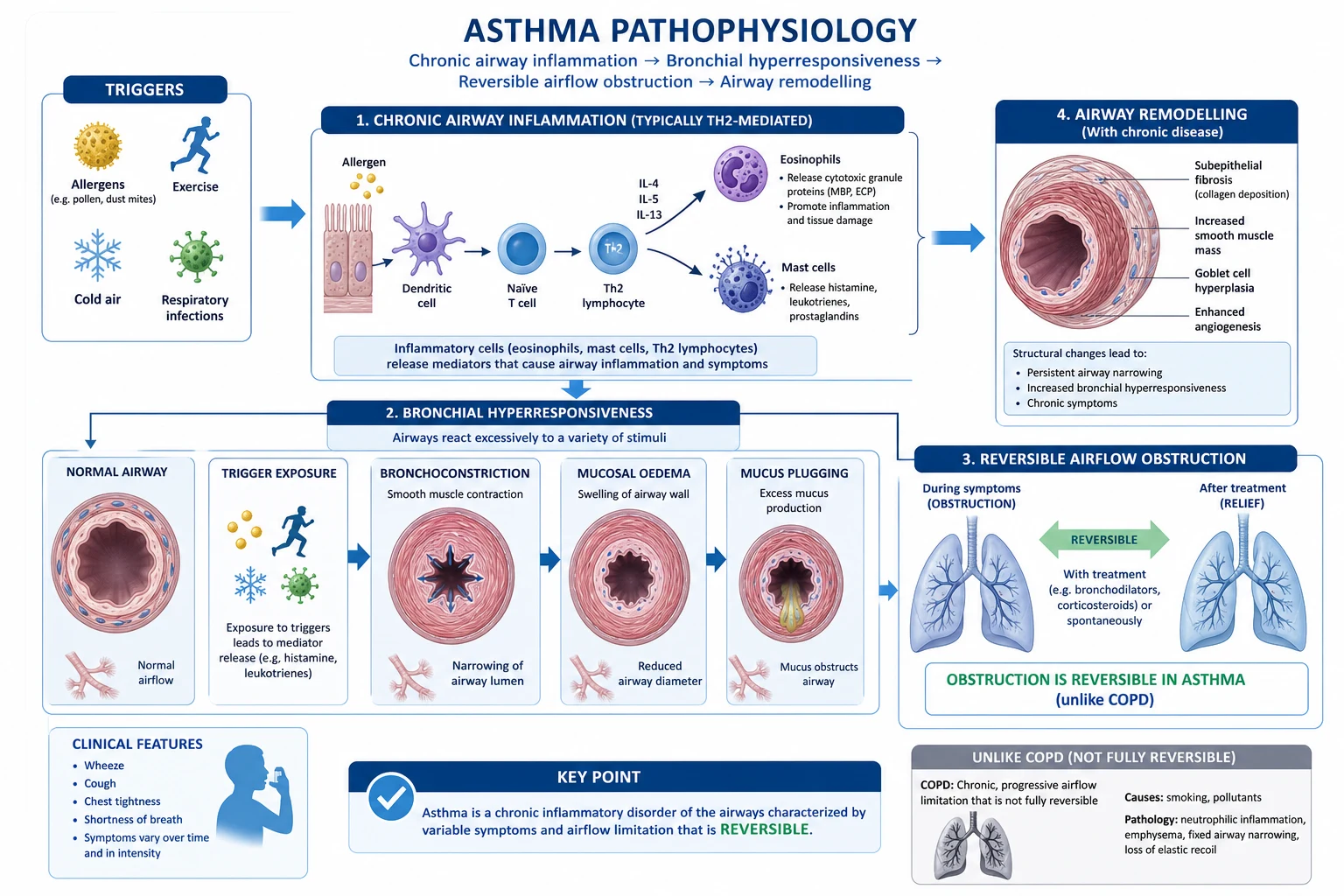 Type-2-high asthma cascade: epithelial alarmins TSLP IL-25 IL-33 activating dendritic cells and ILC2, Th2 cytokines IL-4 IL-5 IL-13, eosinophil and IgE mast-cell effector loop