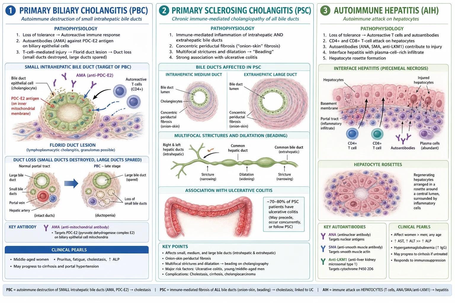 Three-panel pathophysiology infographic comparing PBC, PSC and AIH immune mechanisms