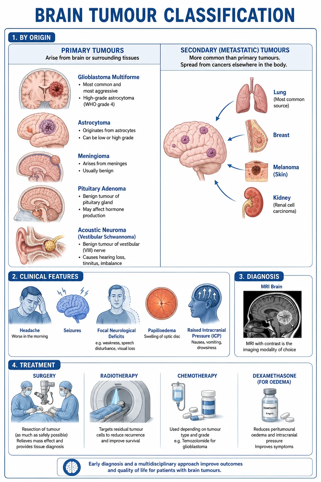 Diagram of glioma molecular pathogenesis showing IDH mutation producing 2-hydroxyglutarate, MGMT methylation and 1p/19q codeletion.