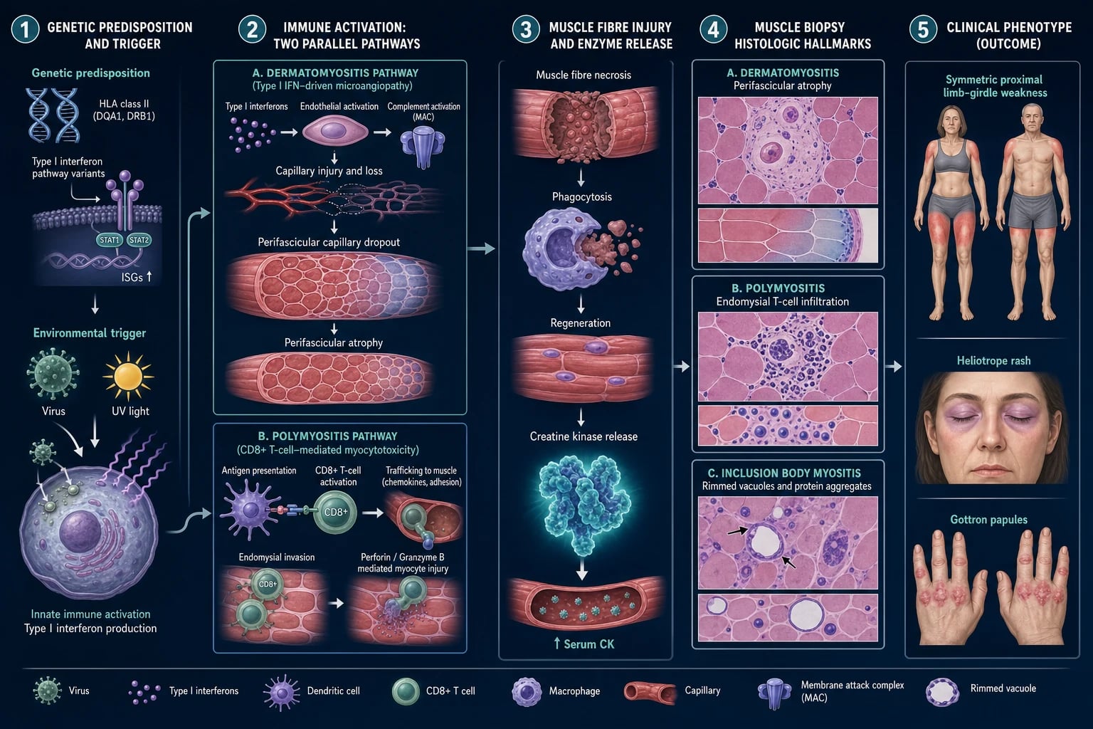 Clean horizontal pathophysiology infographic of the inflammatory myositis autoimmune cascade across five numbered stages, deep navy background