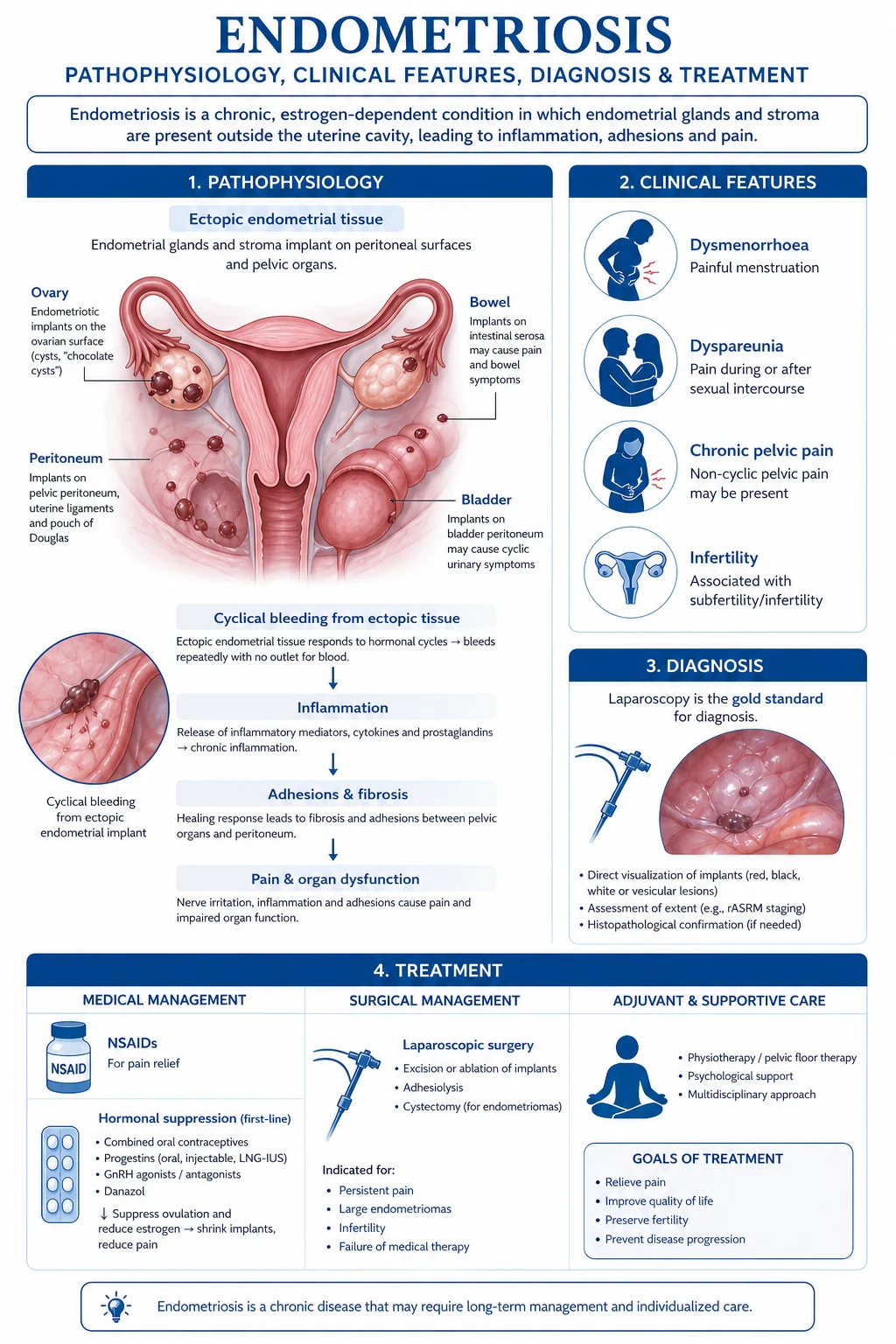 Mechanism infographic: retrograde menstruation to peritoneal implantation to macrophage IL-6/TNF-alpha/prostaglandin release to aromatase self-made oestrogen to angiogenesis to pain and infertility