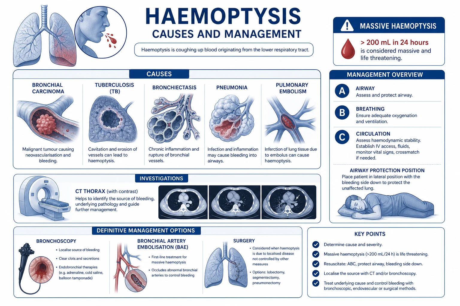 Mechanism infographic: dual blood supply (high-pressure bronchial arteries vs low-pressure pulmonary capillaries); bronchial artery hypertrophy and erosion into bronchus in bronchiectasis/carcinoma/mycetoma; Rasmussen aneurysm in TB cavity; blood flooding airway to asphyxia