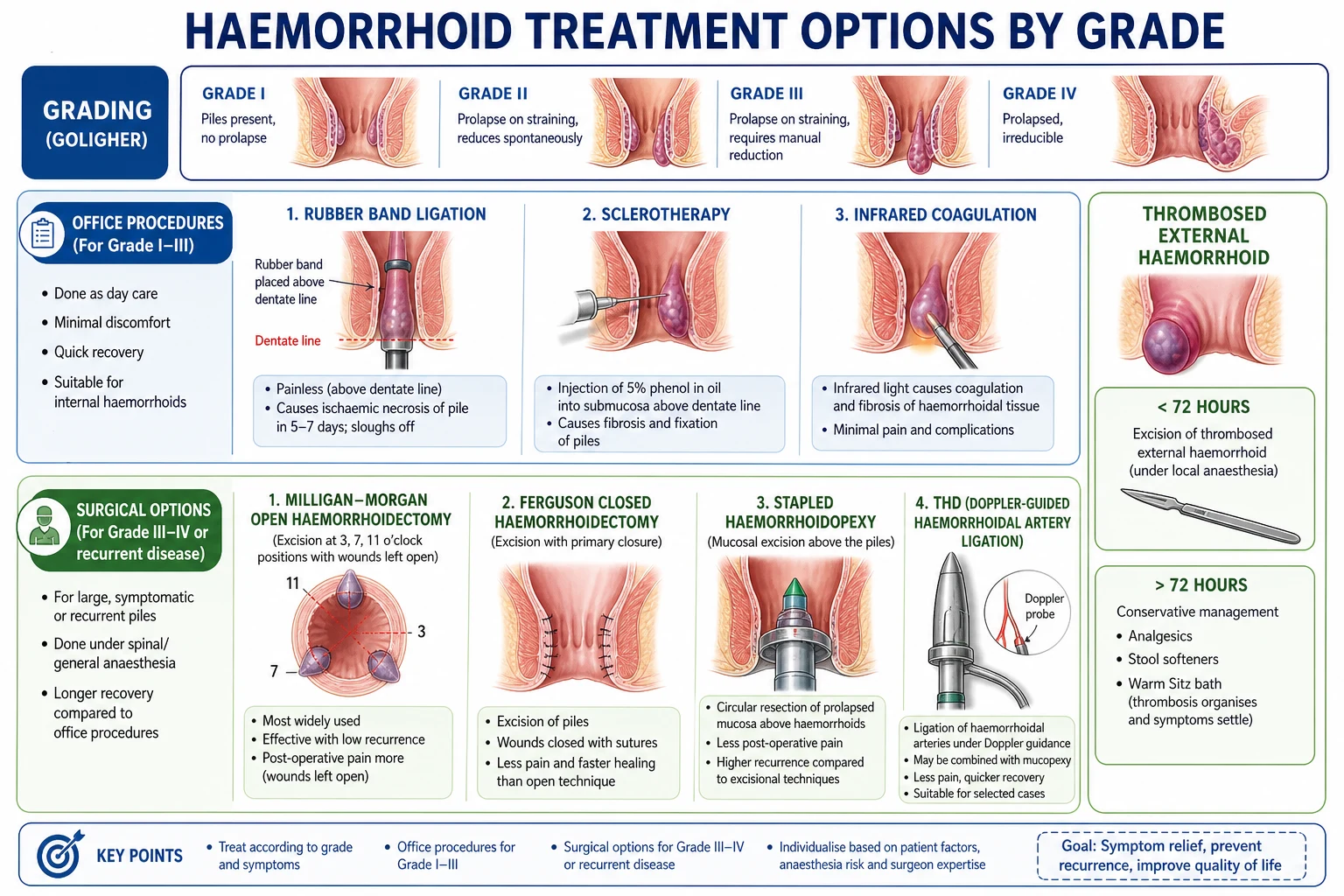 Treatment ladder: dietary modification, rubber band ligation (Grade I-II), haemorrhoidectomy (Grade III-IV). Milligan-Morgan vs Ferguson vs stapled.