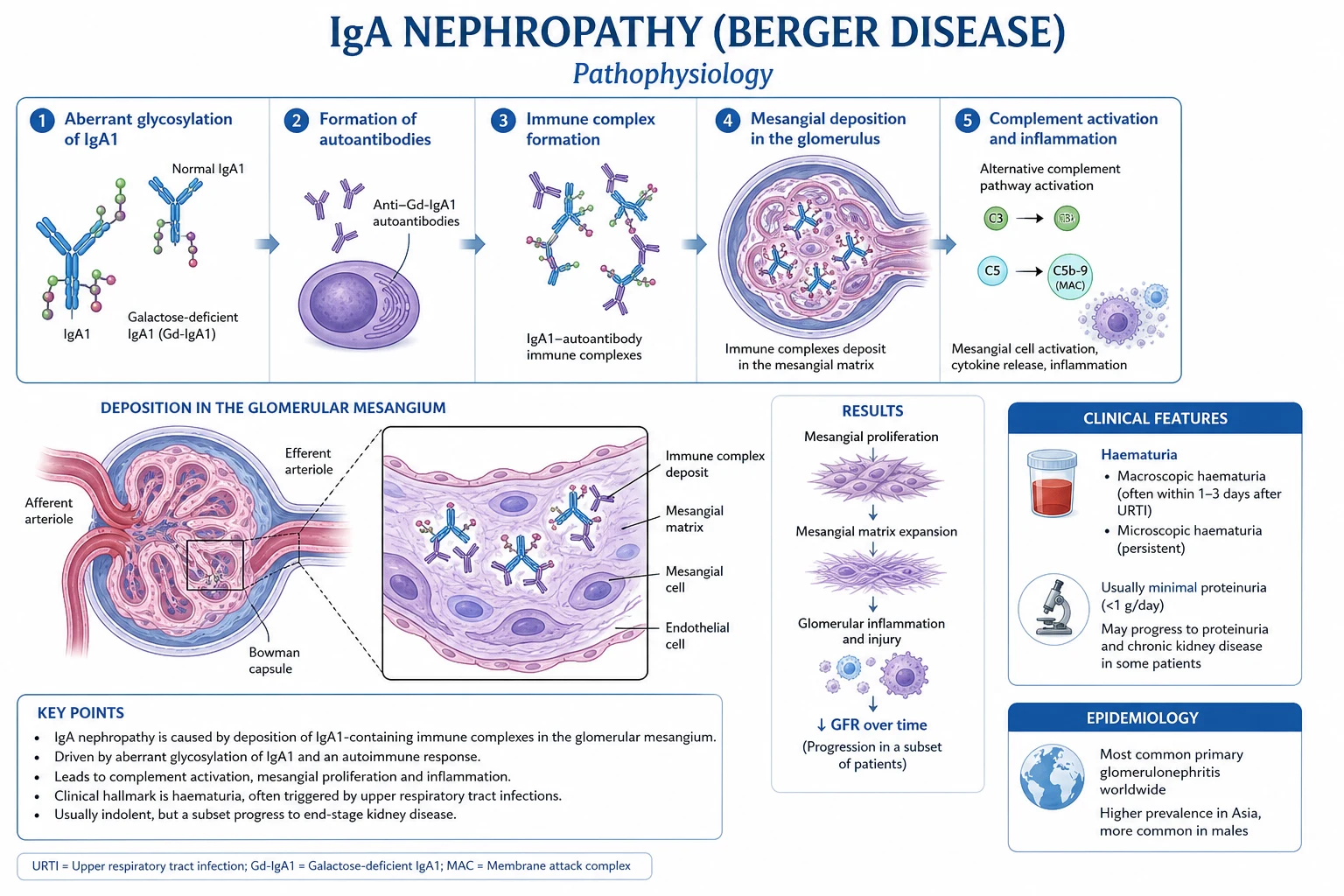 Multi-hit hypothesis of IgA nephropathy — galactose-deficient IgA1 to mesangial injury.