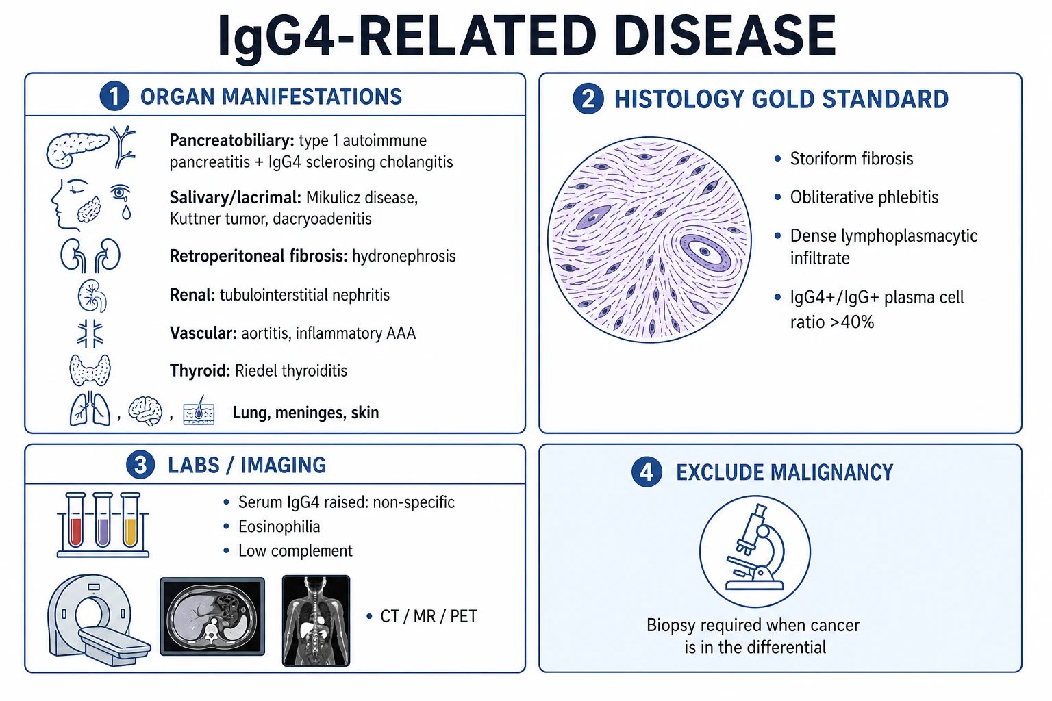 Clean infographic: organ manifestations, histology trio and diagnostic criteria for IgG4-RD