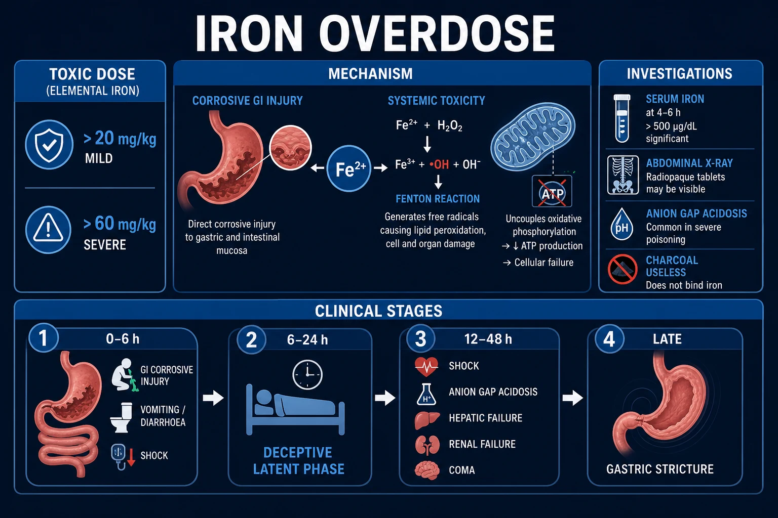 Clean clinical infographic on a deep navy background titled Iron Overdose Classification and Staging, showing the elemental-iron toxic-dose ladder on the left (about 20 mg/kg gastrointestinal effects, 40 mg/kg referral threshold, at least 60 mg/kg systemic toxicity) and clinical stages as a horizontal timeline on the right (early GI corrosive injury, deceptive quiet interval, shock plus acidosis plus hepatic failure, weeks later gastric stricture), with ferrous sulphate noted as 20 percent elemental iron