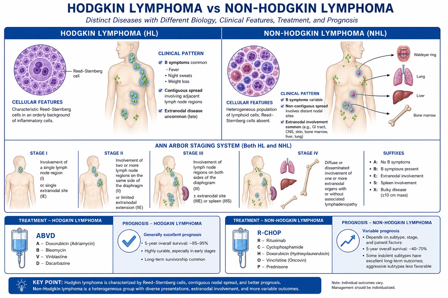 Mechanism infographic: central Reed-Sternberg cell of B-cell origin secreting cytokines that recruit reactive lymphocytes and eosinophils; contiguous nodal spread; plus NHL molecular translocations t(8;14) t(14;18) t(11;14)