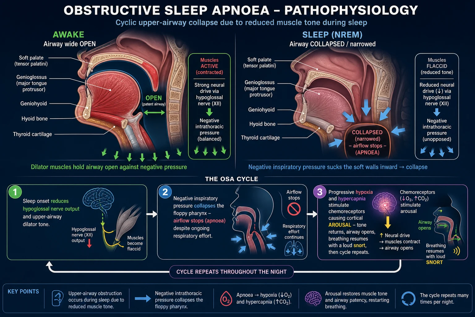 Pathophysiology flow diagram of an obstructive apnoea cycle: sleep onset, airway collapse, hypoxia, arousal, reopening