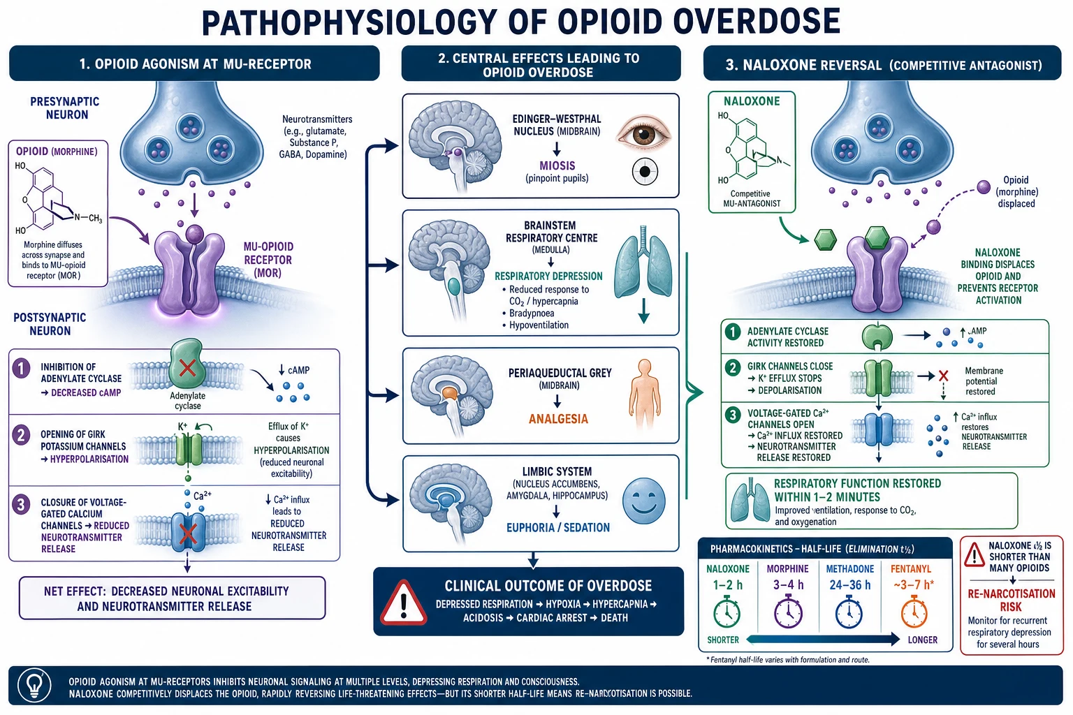 Clean modern medical diagram of opioid-overdose pathophysiology: neural synapse with mu-opioid receptor signalling and naloxone competitive antagonism, with arrows to the Edinger-Westphal nucleus, medullary respiratory centre, and a naloxone duration vs opioid duration inset