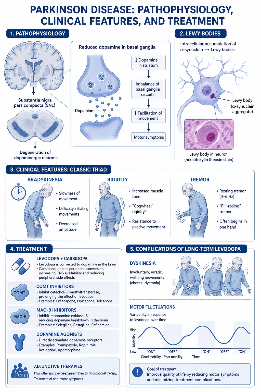 Mechanism infographic — substantia nigra dopaminergic neuron loss, alpha-synuclein Lewy body, direct or indirect basal ganglia pathway imbalance, Braak caudal-to-rostral spread