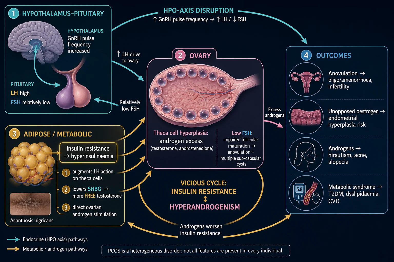 Labelled medical flow diagram of PCOS pathophysiology showing the insulin resistance and hyperandrogenism vicious cycle, HPO axis disruption, and clinical outcomes