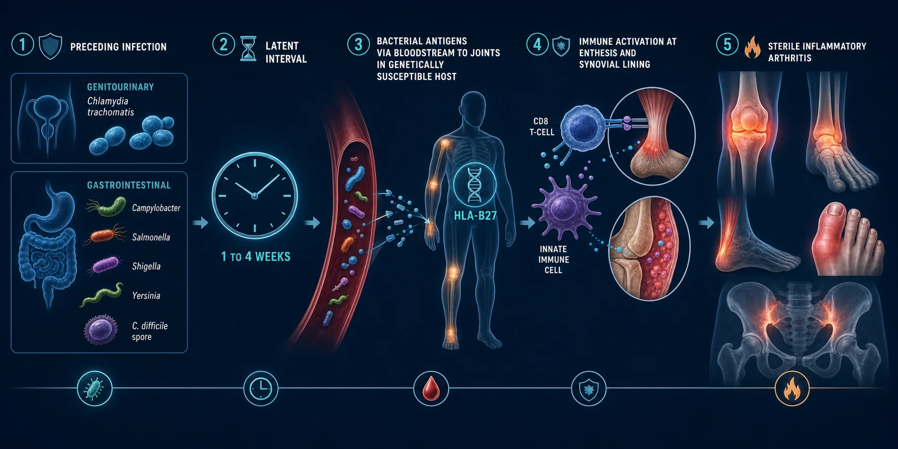 Clean horizontal pathophysiology infographic: distant mucosal infection, 1 to 4 week latency, bacterial antigen trafficking to the joint in an HLA-B27 host, CD8 T-cell and innate IL-17/23 activation at enthesis and synovium, sterile asymmetric lower-limb oligoarthritis with dactylitis, deep navy background