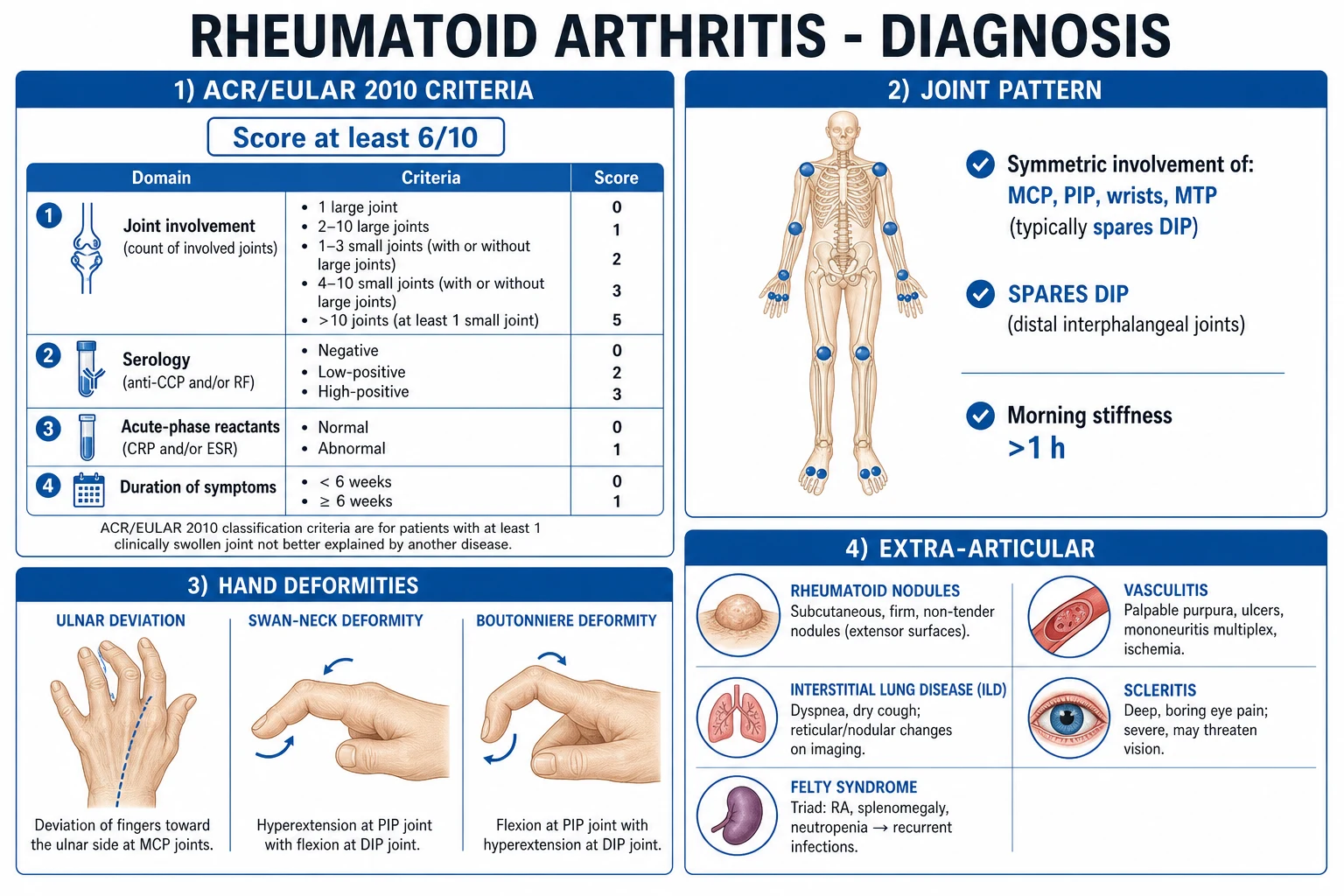 Clean stepwise management infographic: NSAID + bridge steroid + methotrexate first DMARD, then triple csDMARD therapy, then biologic (anti-TNF / tocilizumab / rituximab / abatacept), then JAK inhibitor, all under treat-to-target DAS28