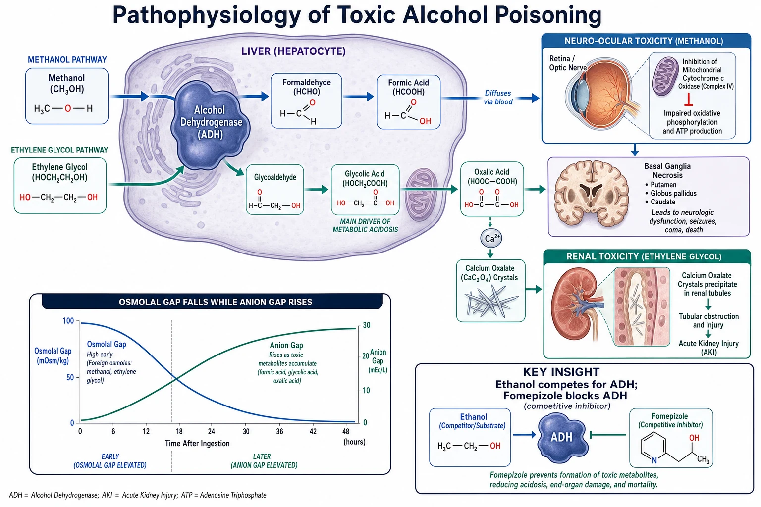 Pathophysiology infographic: ADH converting methanol to formaldehyde to formic acid (retina/basal ganglia), and ethylene glycol to glycolic/oxalic acid (kidney); graph of osmolal gap falling and anion gap rising over time; ethanol competing for ADH and fomepizole blocking it