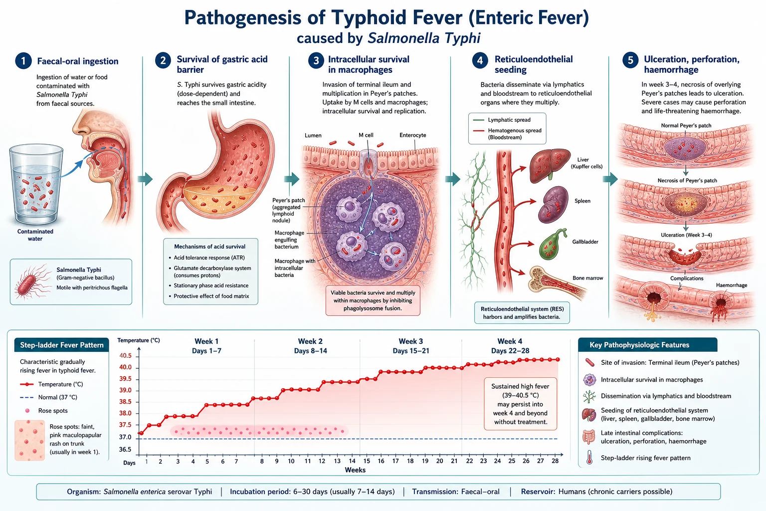 Mechanism infographic: faecal-oral ingestion through gastric acid survival, invasion of Peyer's patches, intracellular survival in macrophages via SPI-1/SPI-2 secretion systems, reticuloendothelial seeding to liver, spleen, bone marrow and gallbladder, and week 3-4 Peyer's patch ulceration, perforation and haemorrhage; with a step-ladder fever curve