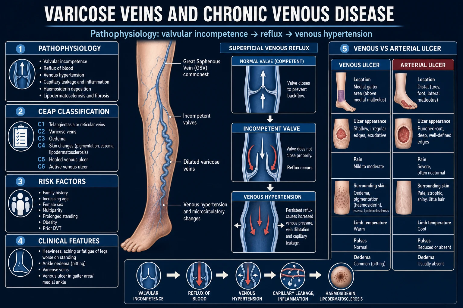 CEAP clinical classification C0 to C6 illustrated on the leg, with the medial gaiter ulcer zone marked.