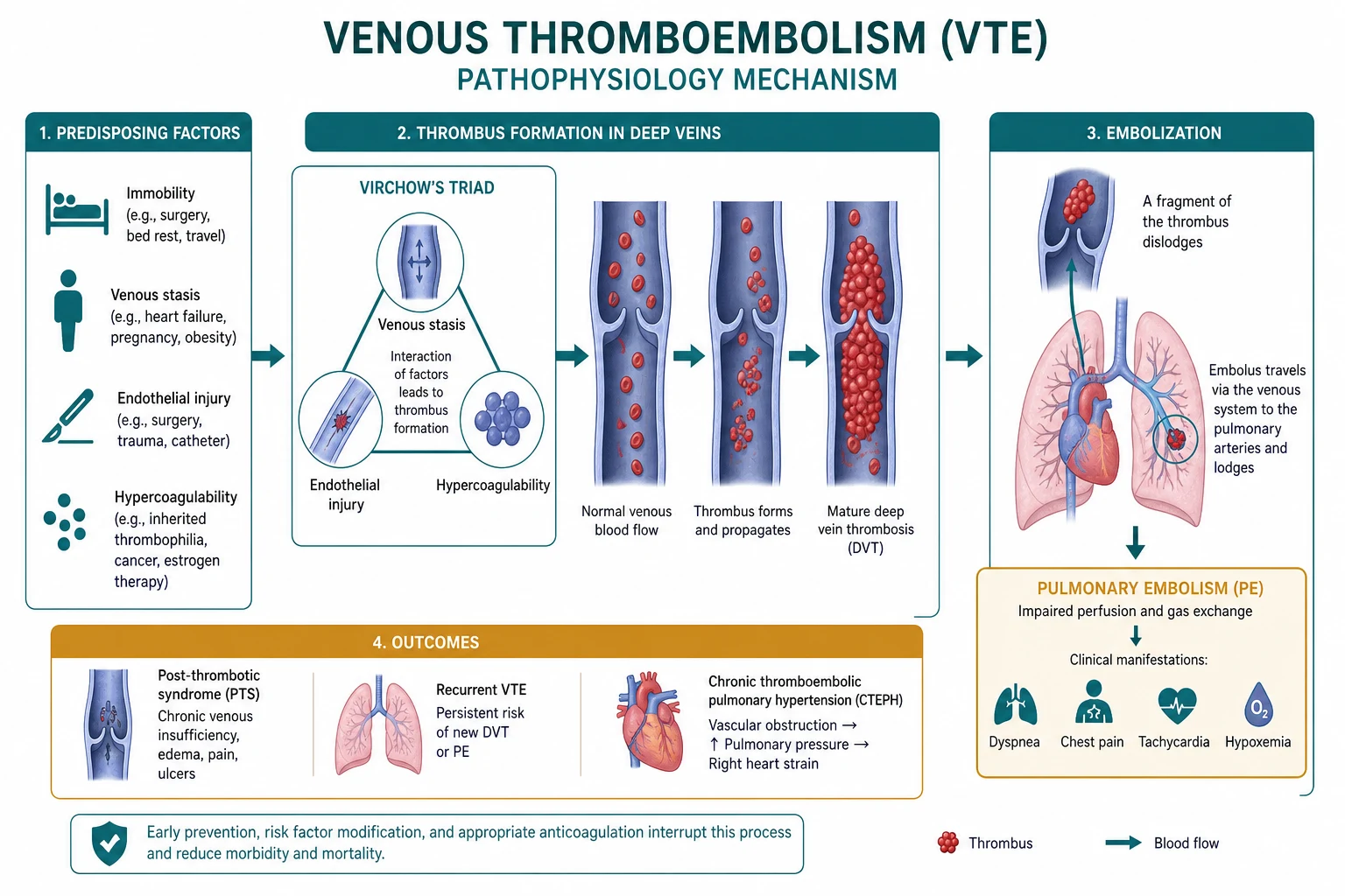 Venous thromboembolism pathophysiology educational diagram